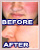 facial blushing