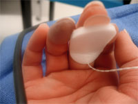 raynauds before