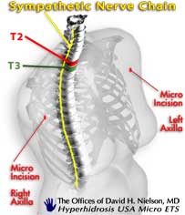 sympathetic & kuntz nerves